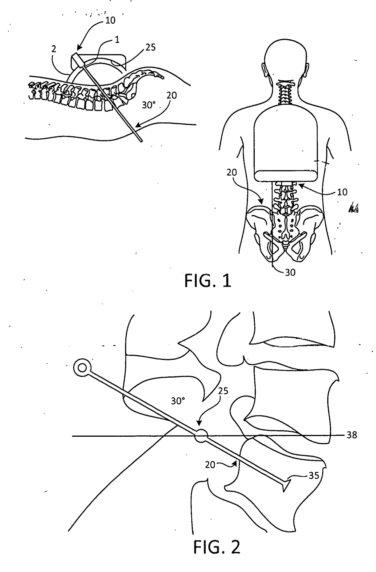 Surgical targeting systems and methods