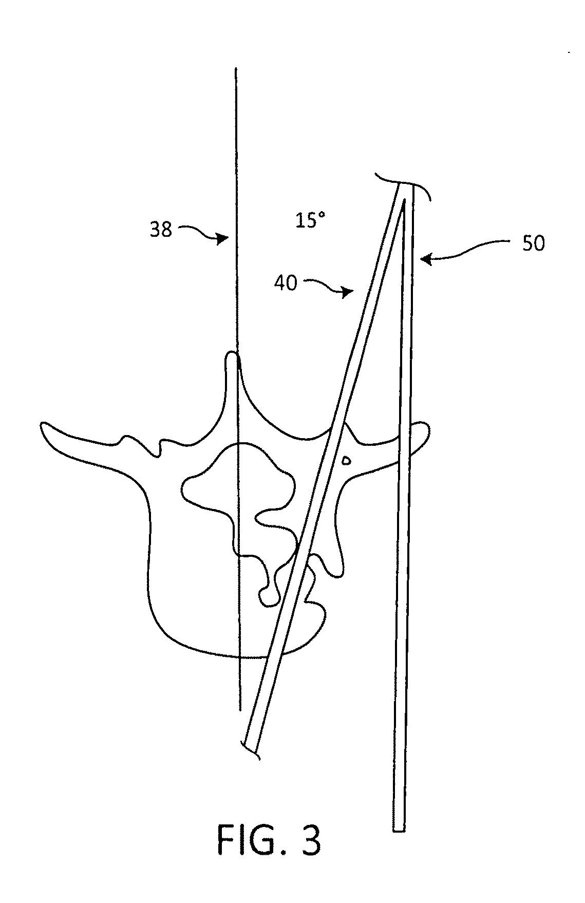 Surgical targeting systems and methods