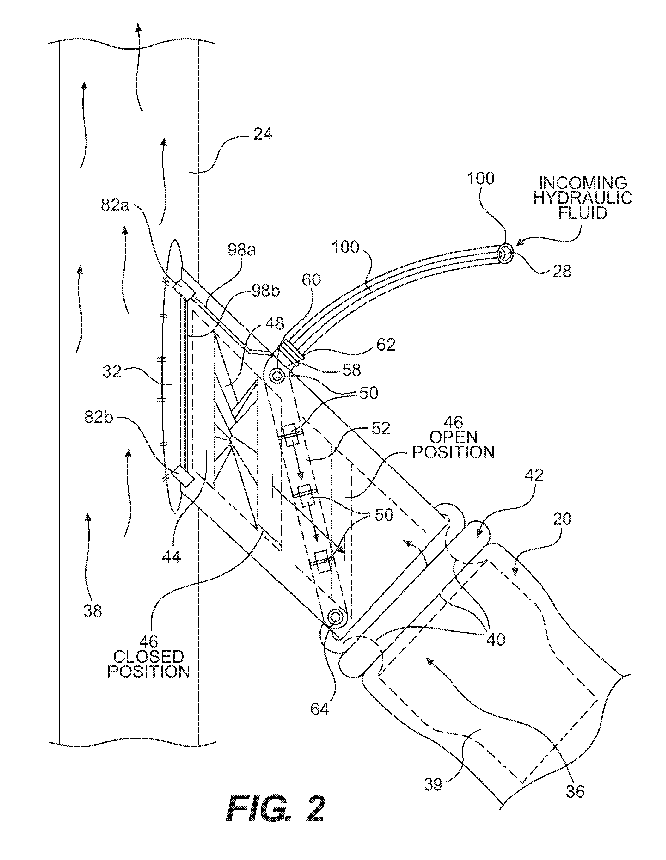 Arteriovenous shunt with integrated surveillance system