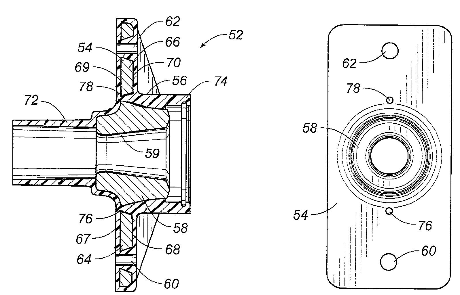 Tendon tensioning anchor system having polymeric encapsulation with reduced shrinkage effects