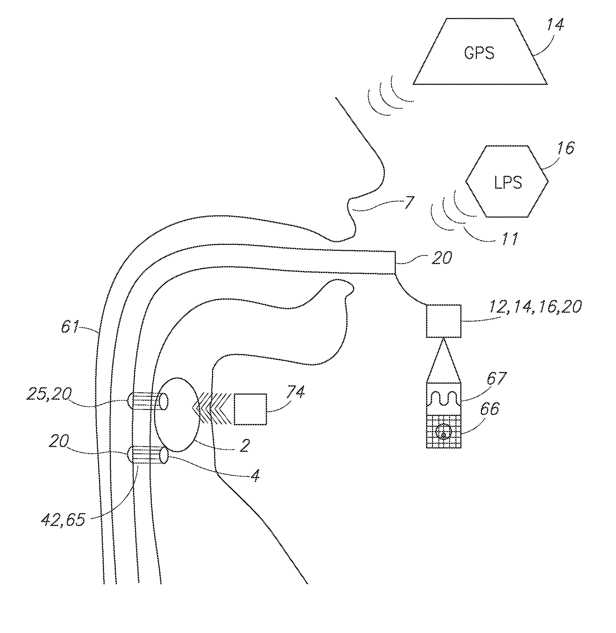 Localization of the parathyroid