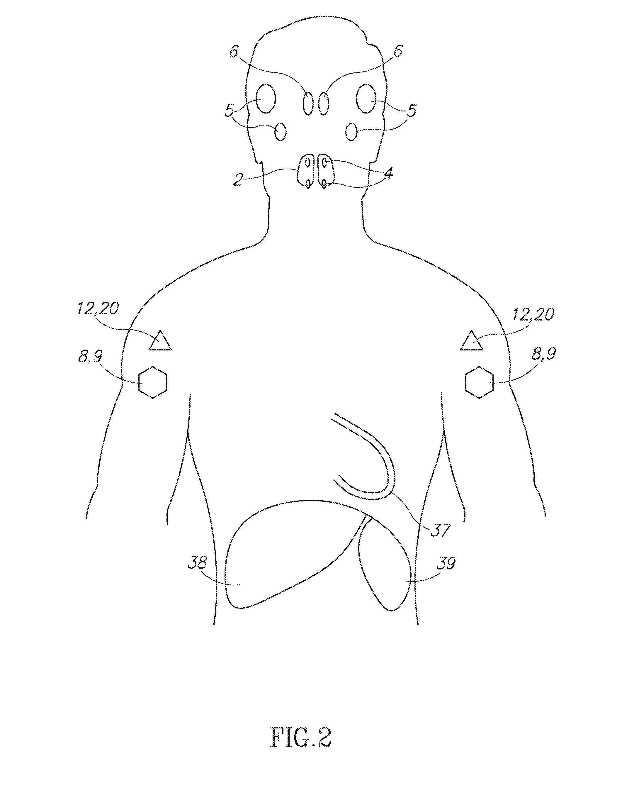 Localization of the parathyroid