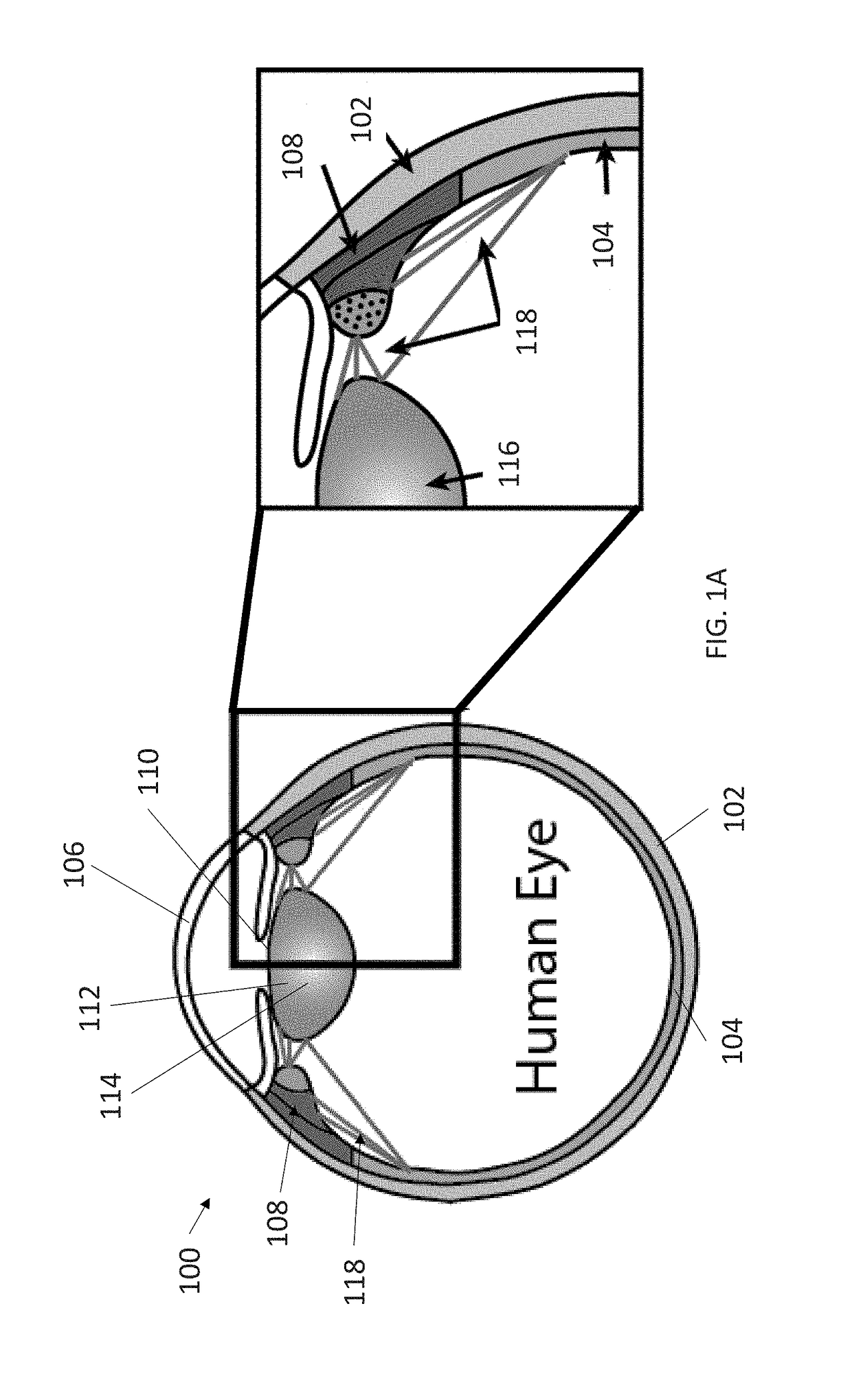 System and methods using real-time predictive virtual 3D eye finite element modeling for simulation of ocular structure biomechanics