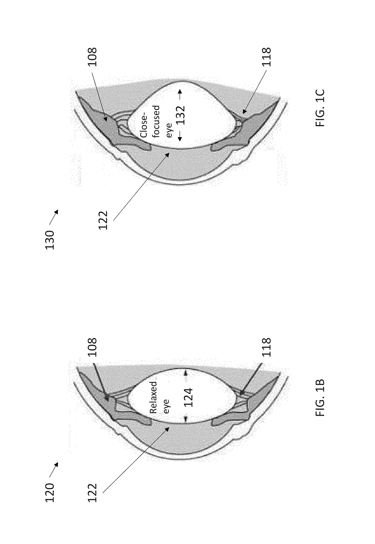 System and methods using real-time predictive virtual 3D eye finite element modeling for simulation of ocular structure biomechanics