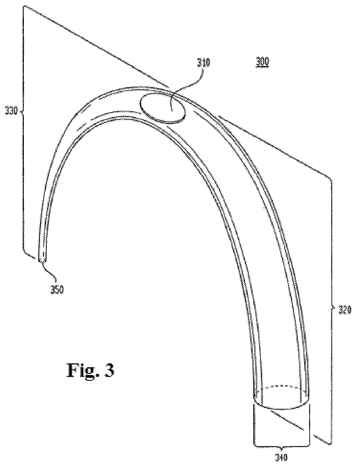 Vessel Access Catheter Method of Use