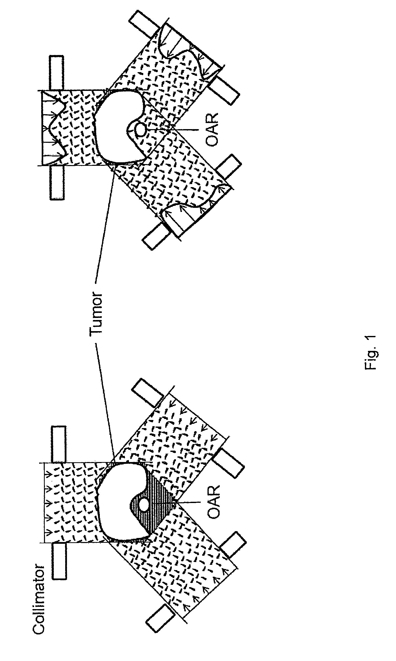 Radiation treatment planning system and computer program product