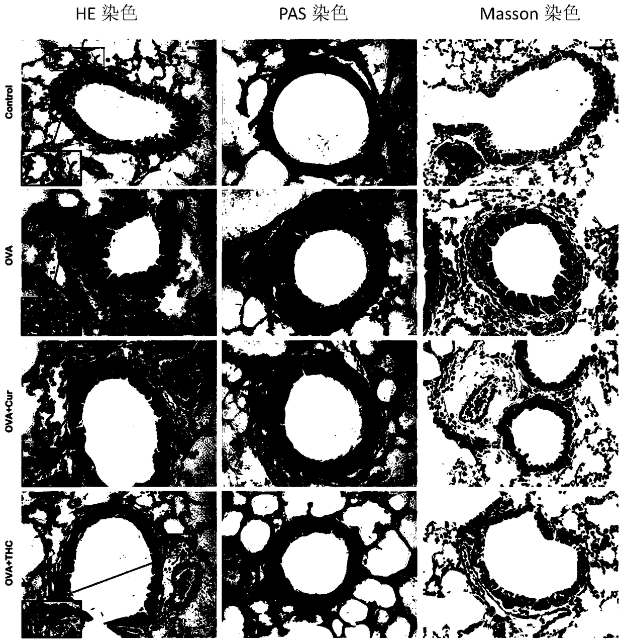 Application of tetrahydrocurcumin in improving allergic asthma