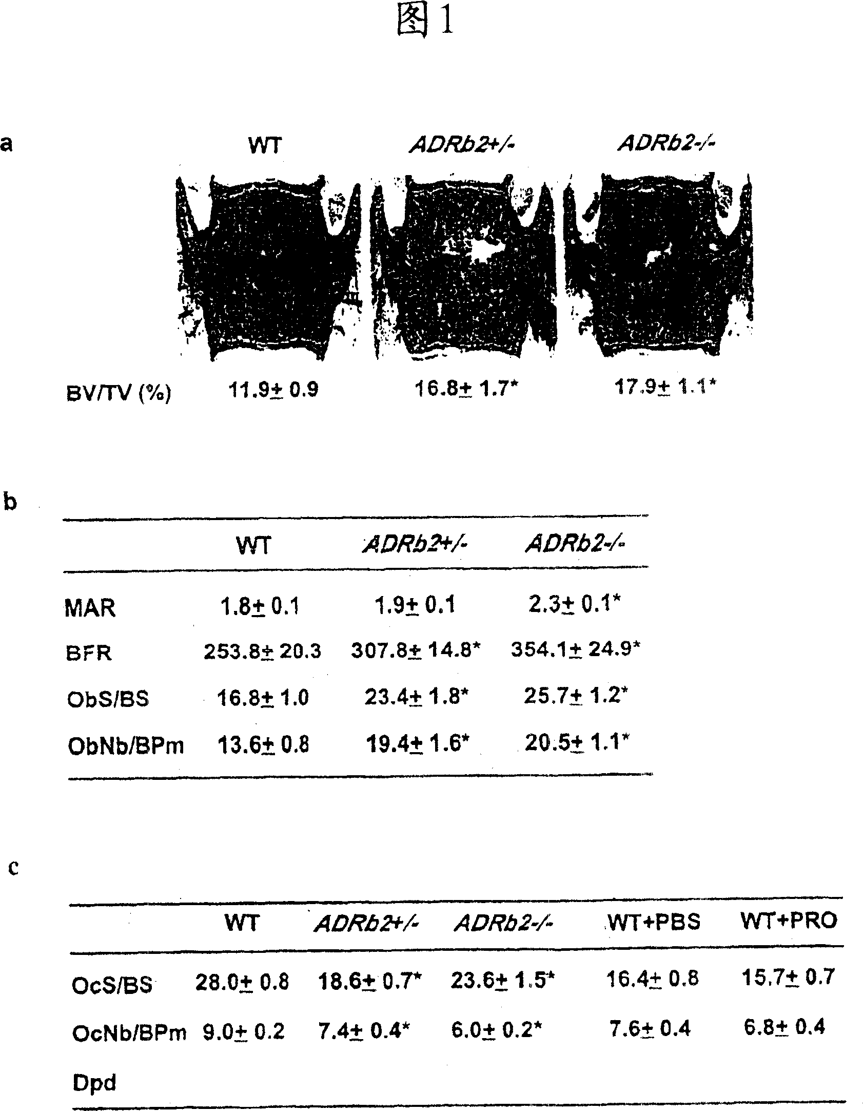 Compositions and methods for modulating bone mass