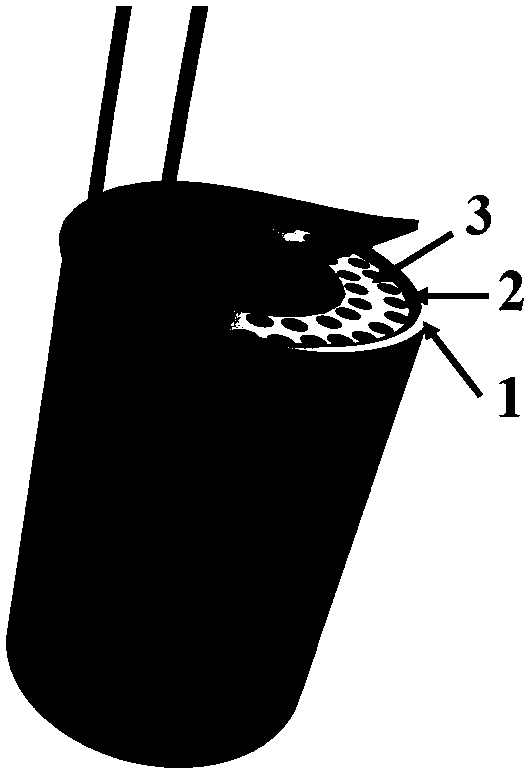 Sleeve-type elastic porous piezoresistive sensor for detecting ureter damage