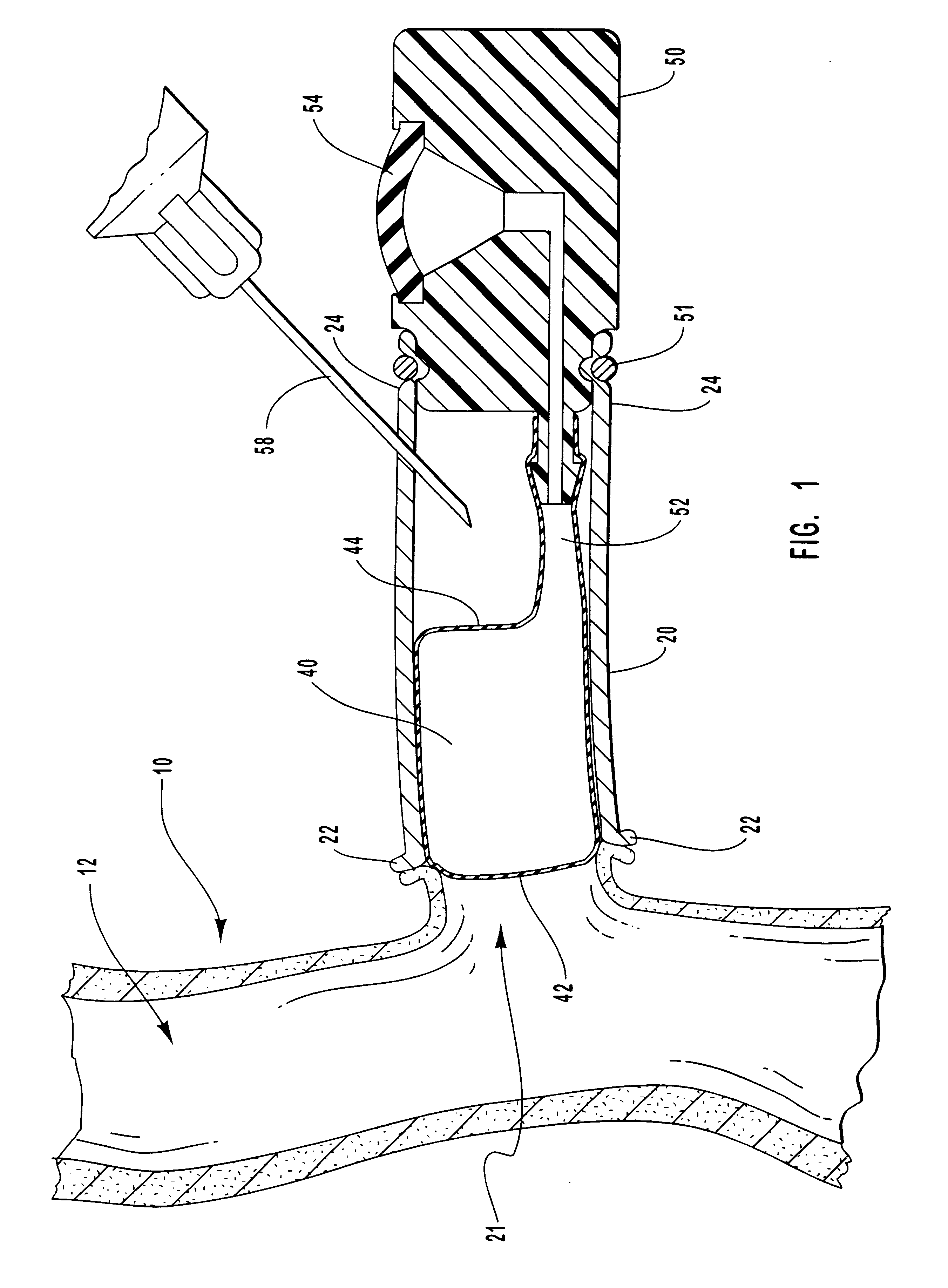 Methods for external treatment of blood