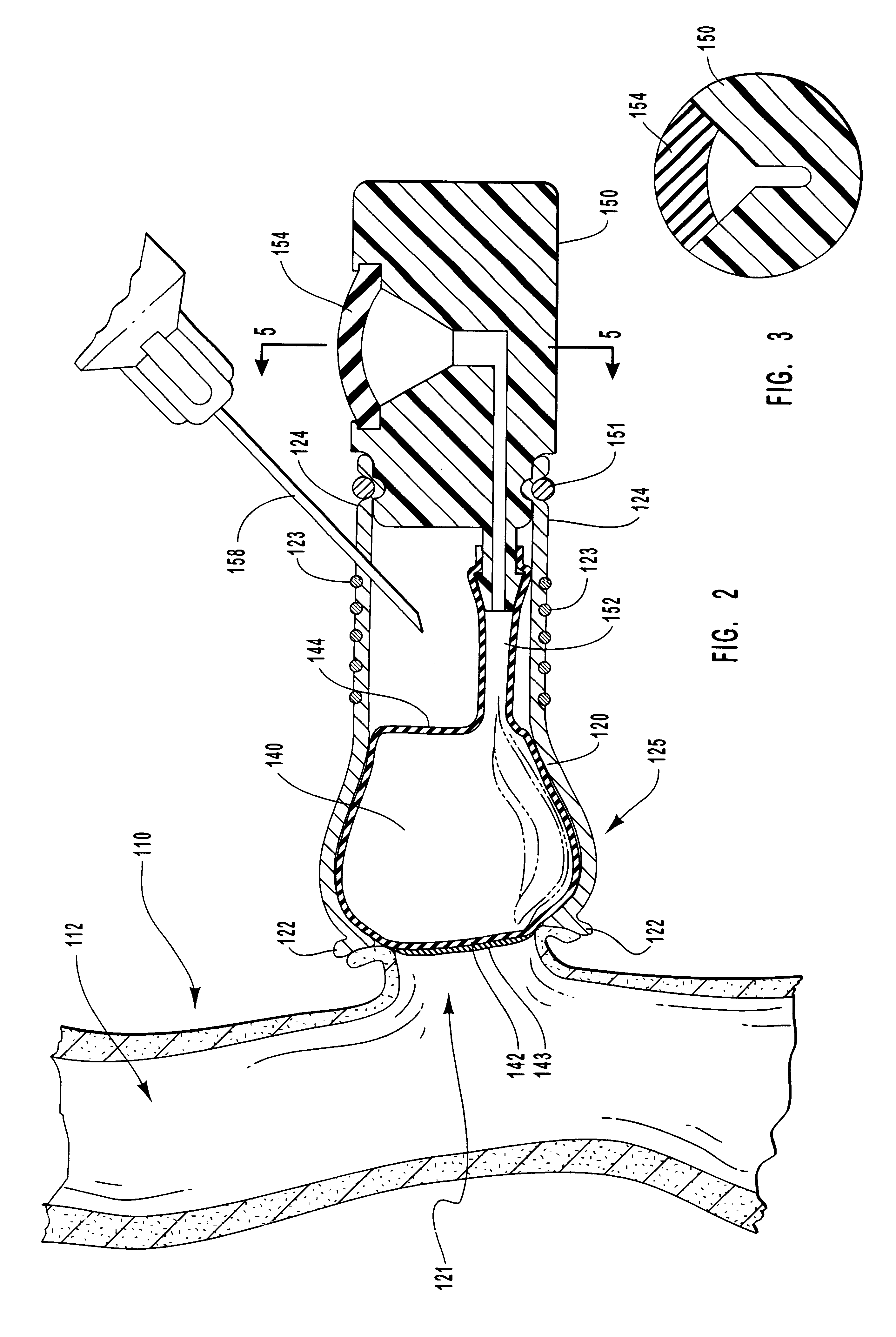 Methods for external treatment of blood