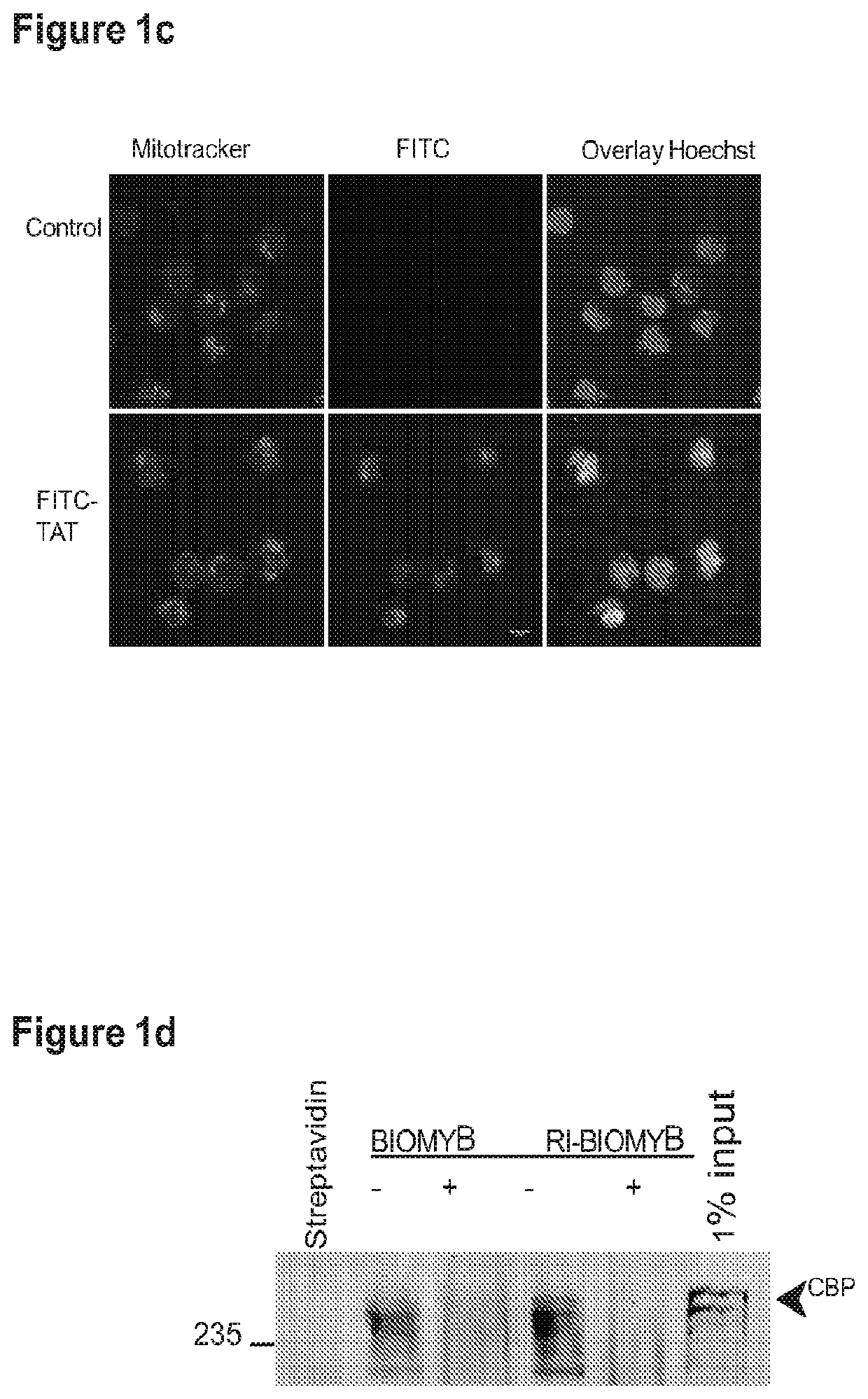 Agents and methods for treating CBP-dependent cancers