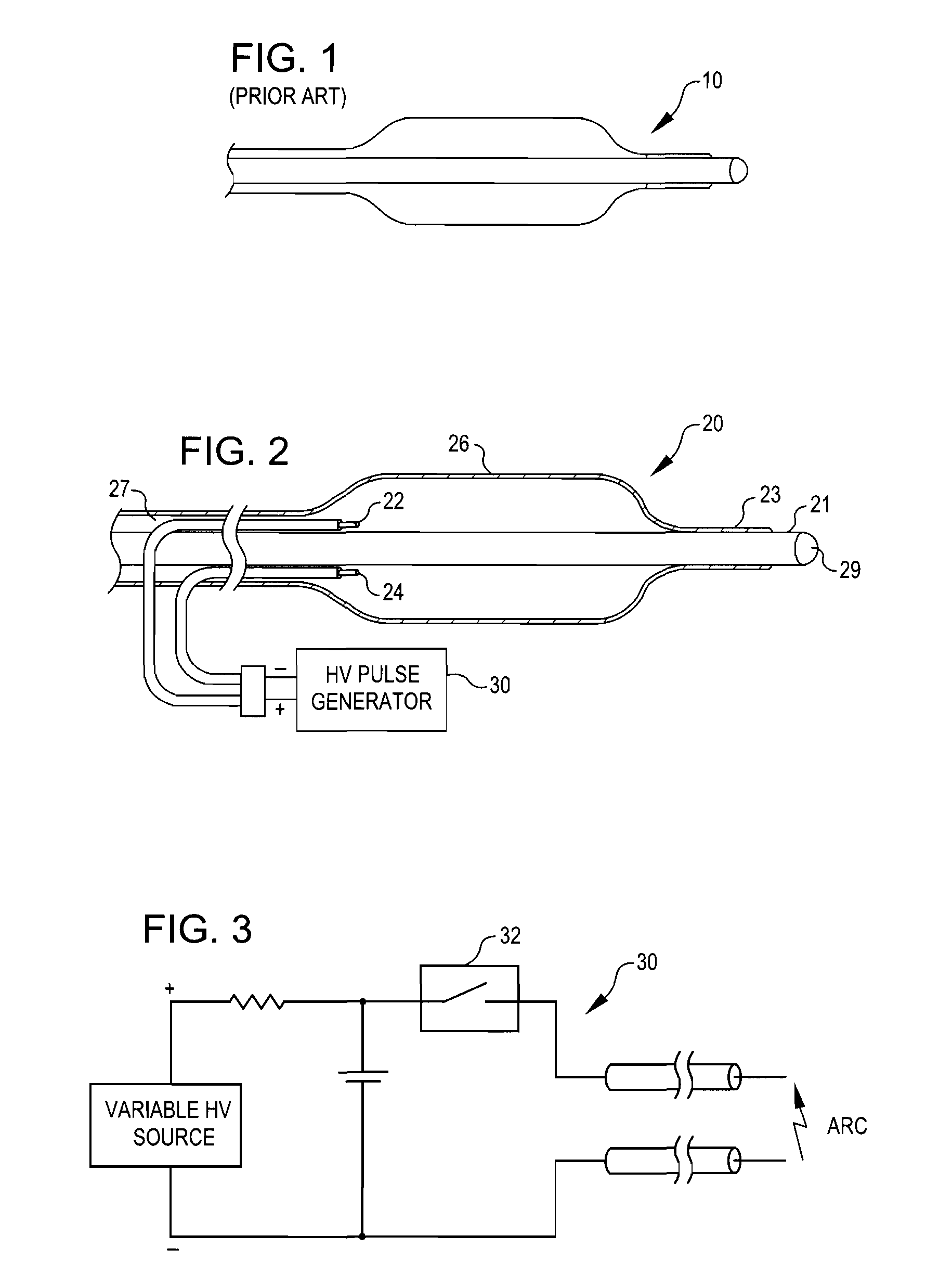 Shockwave balloon catheter system