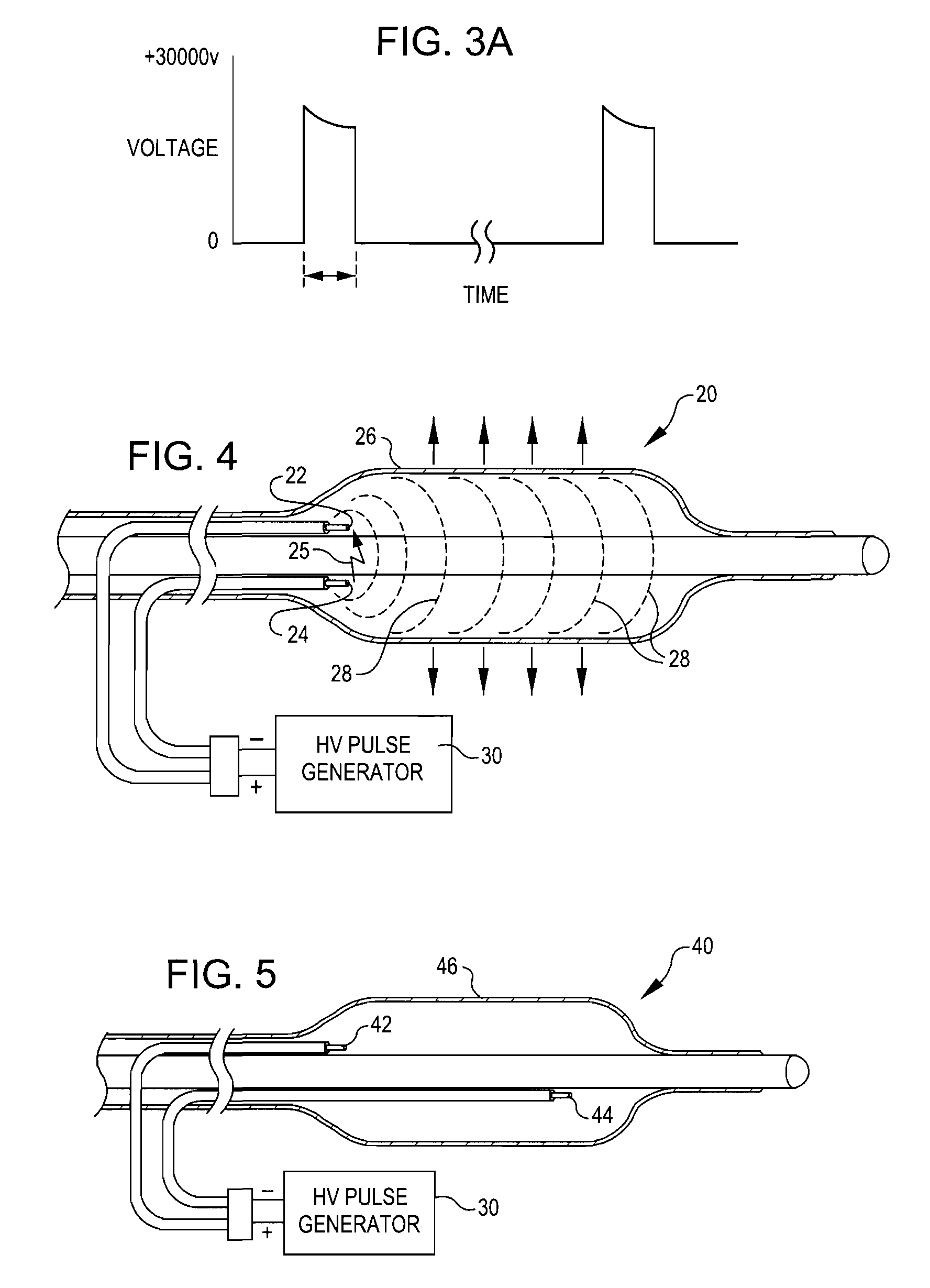 Shockwave balloon catheter system