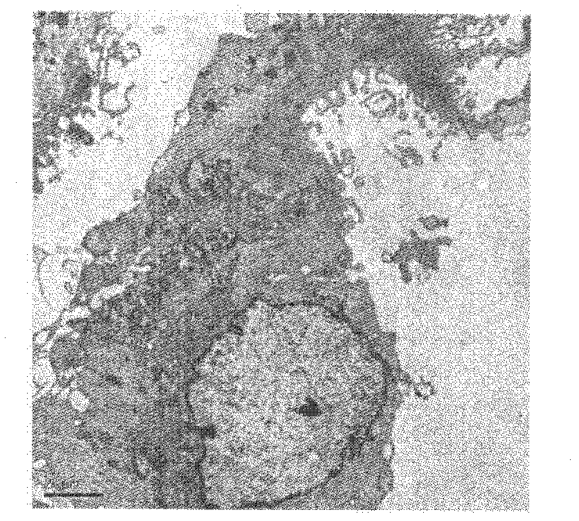 Method for extracting pulmonary mesenchymal stem cells