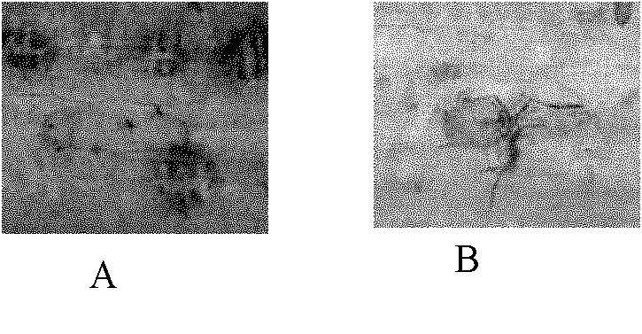 Protein TaWRKY2 related to powdery mildew resistance and coding gene of protein TaWRKY2