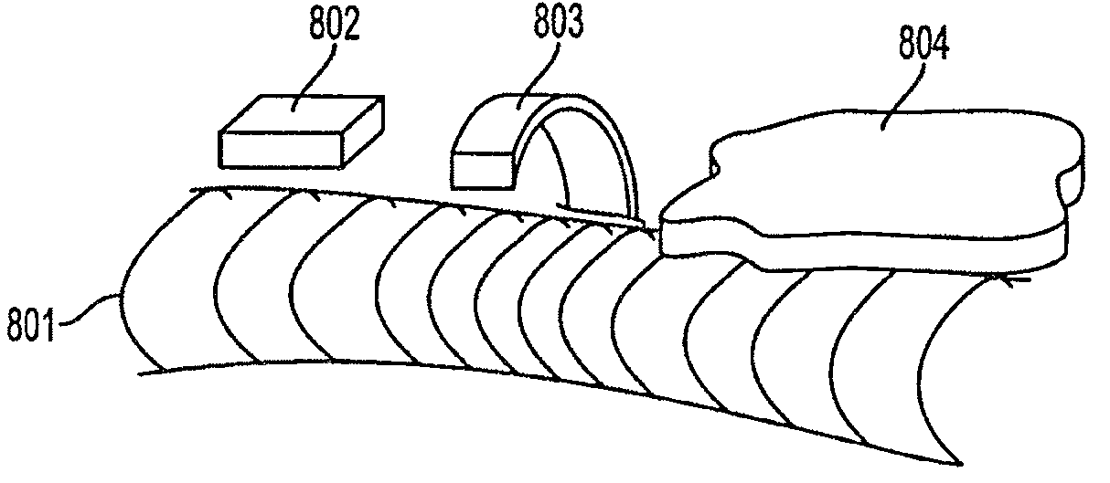 Composite stent with inner and outer stent elements and method of using the same