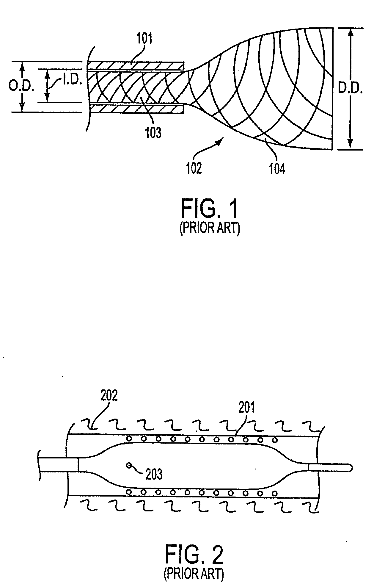 Composite stent with inner and outer stent elements and method of using the same