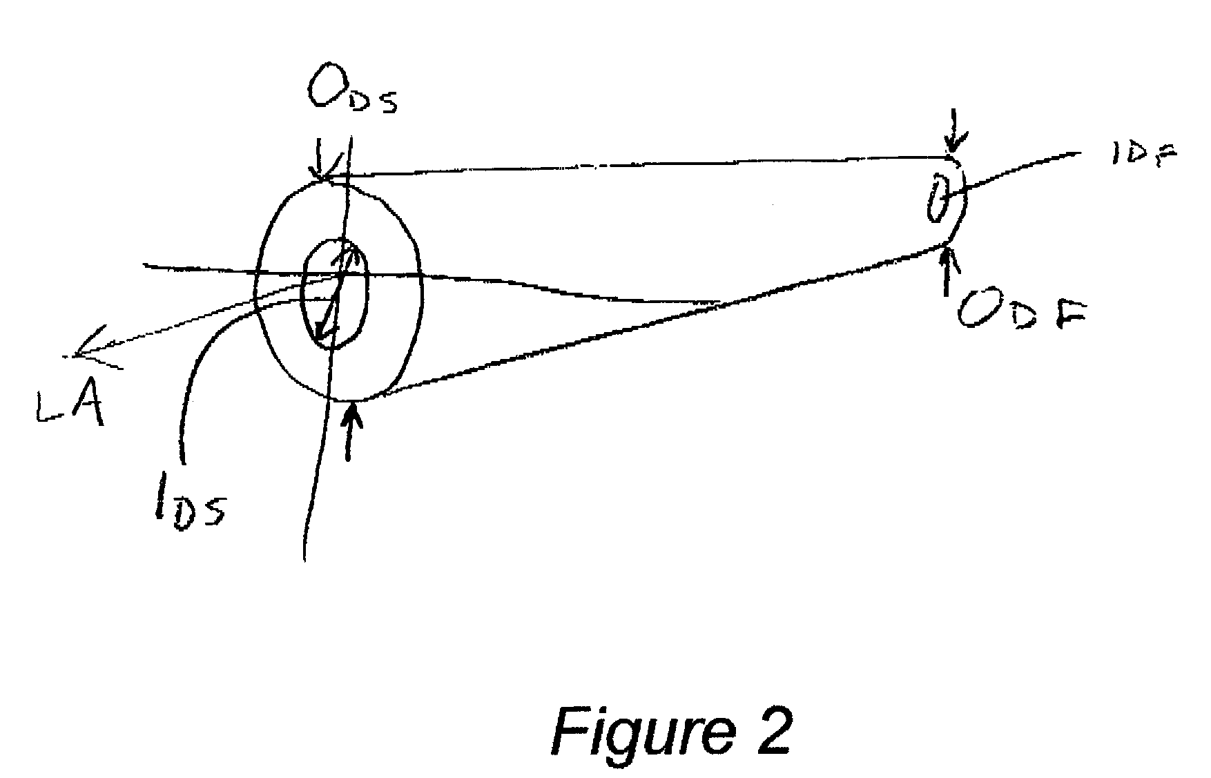 Sports equipment having a tubular structural member