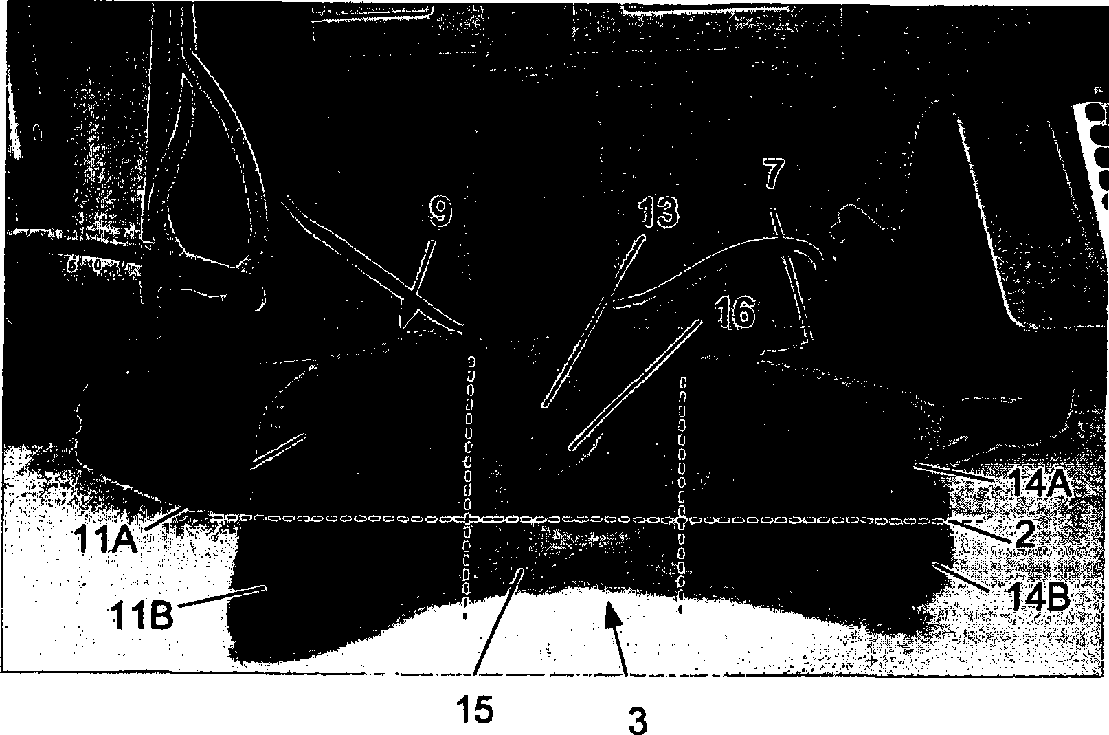 An intraoral cpap interface