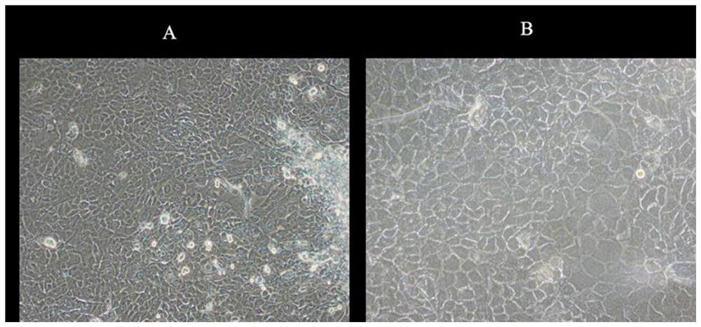 Immortalized yak rumen epithelial cell line and construction method thereof