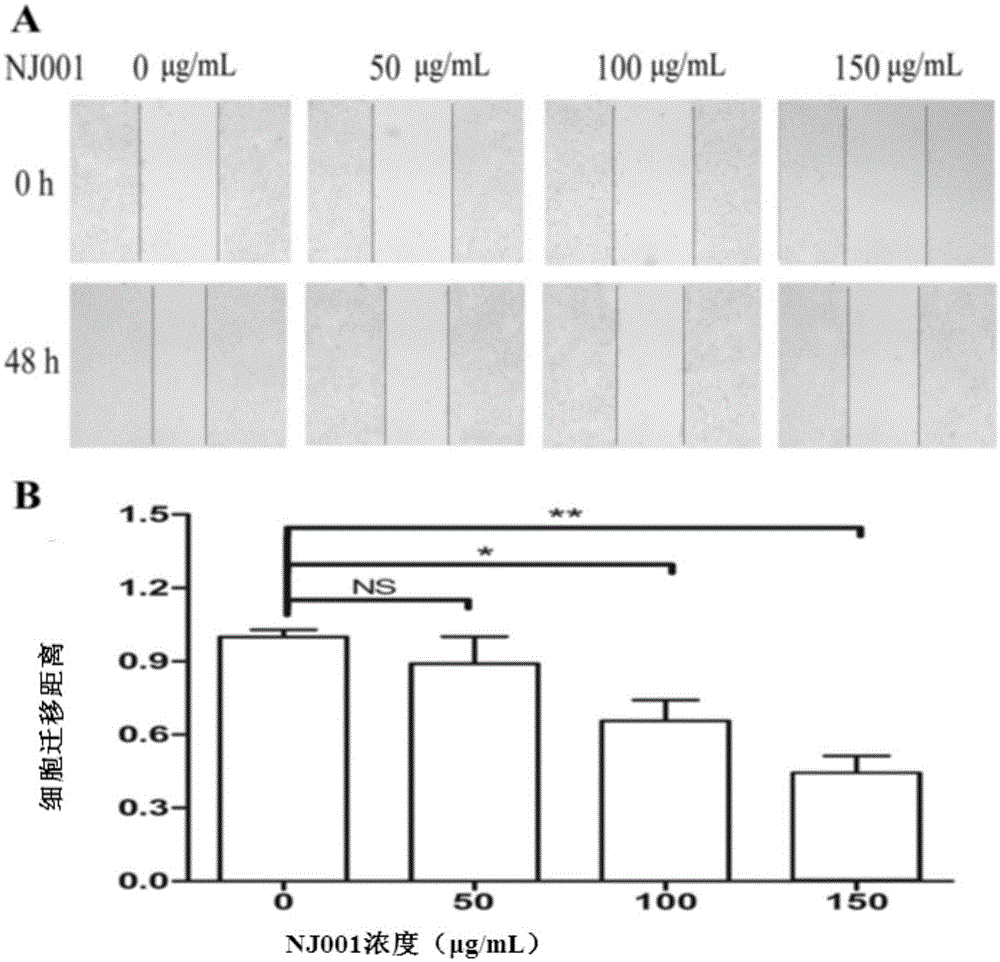 Application of monoclonal antibody NJ001-1 to preparation of drug for inhibiting invasion and metastasis of NSCLC (non-small-cell lung cancer)