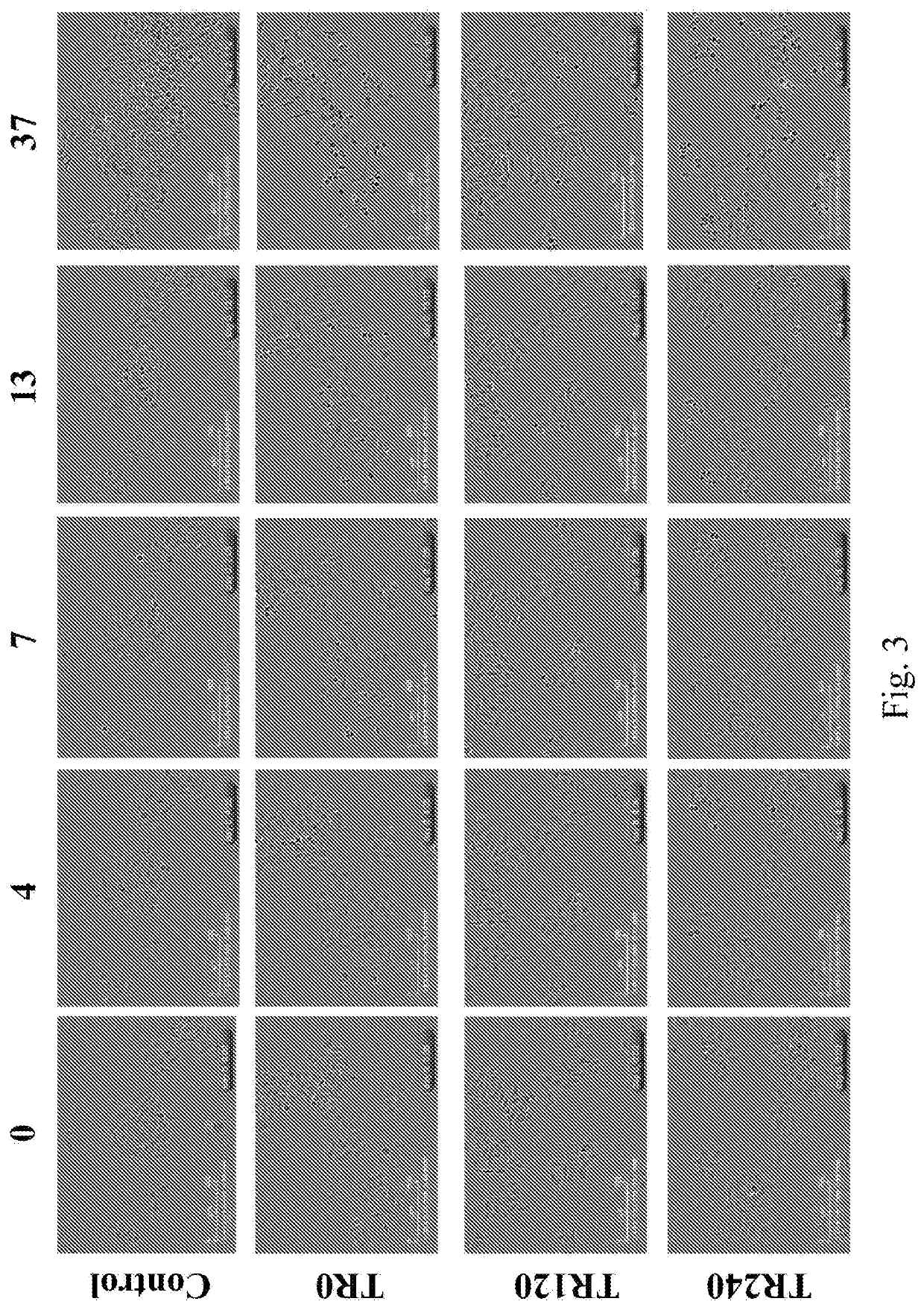 Triptonide or a composition comprising triptonide for use in treating disorders