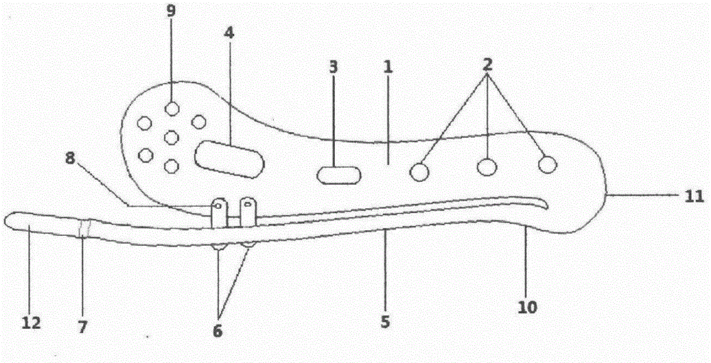 Elastic internal clavicle fixator