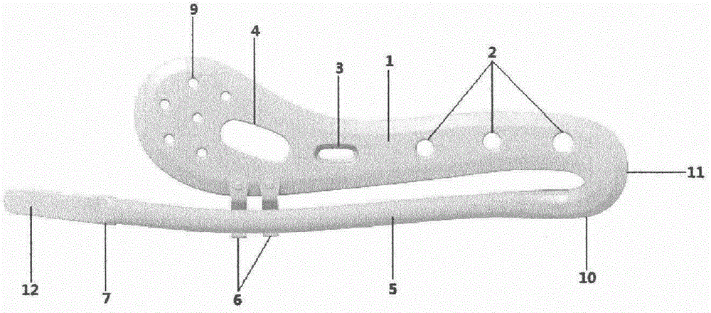 Elastic internal clavicle fixator