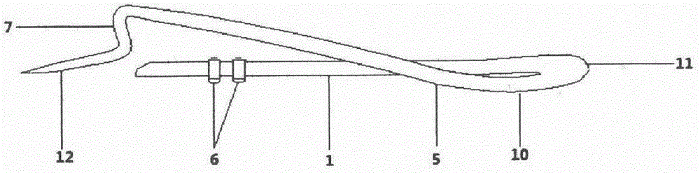 Elastic internal clavicle fixator