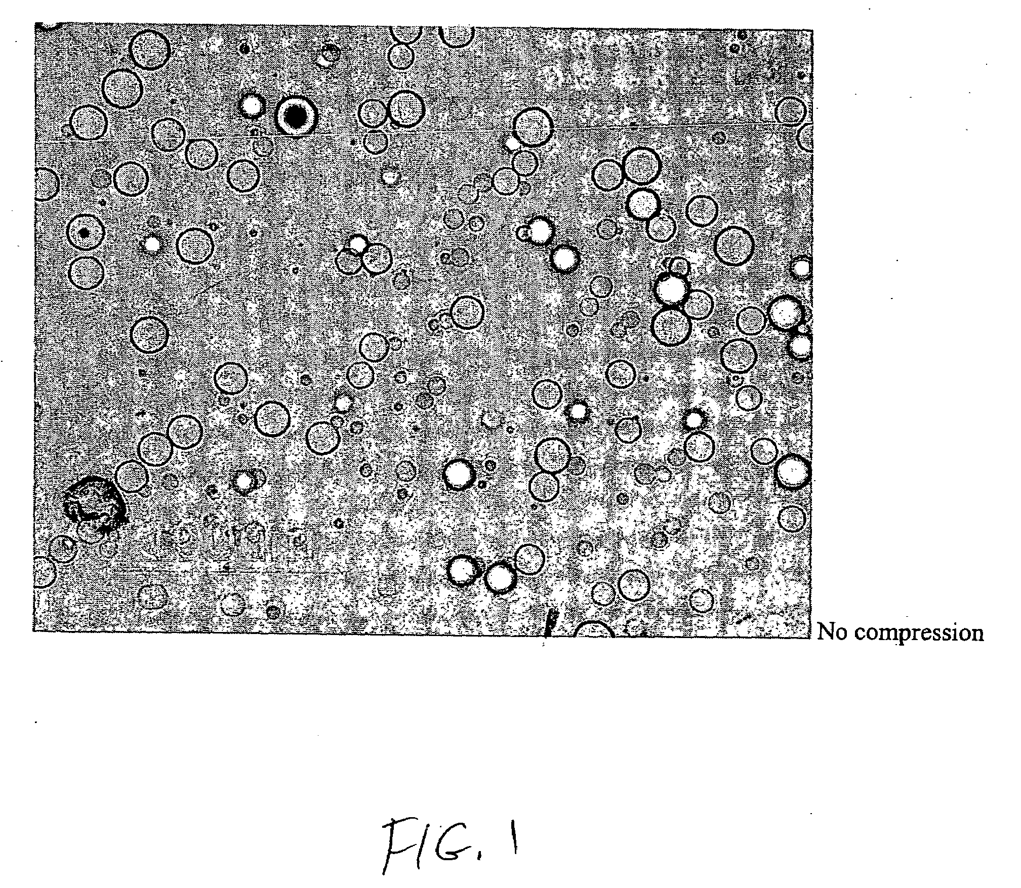 Hypercompressed polymer particles for controlled release ophthalmic medications