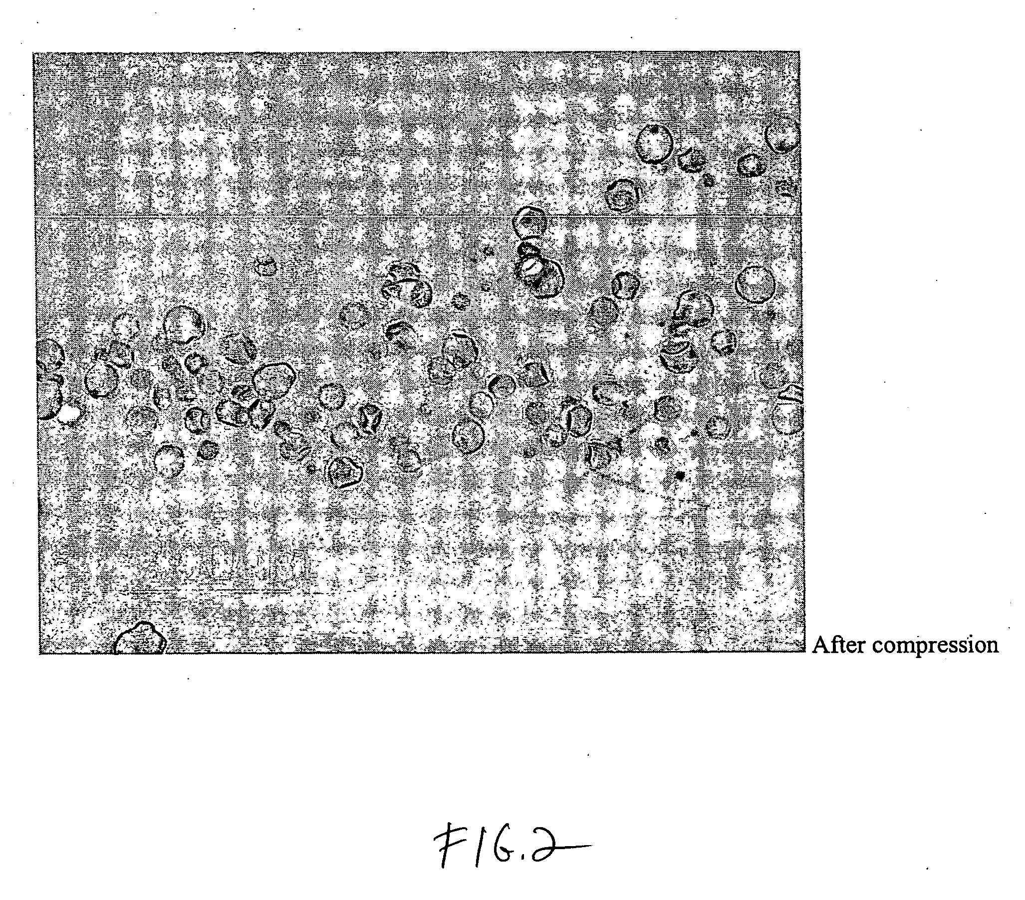 Hypercompressed polymer particles for controlled release ophthalmic medications