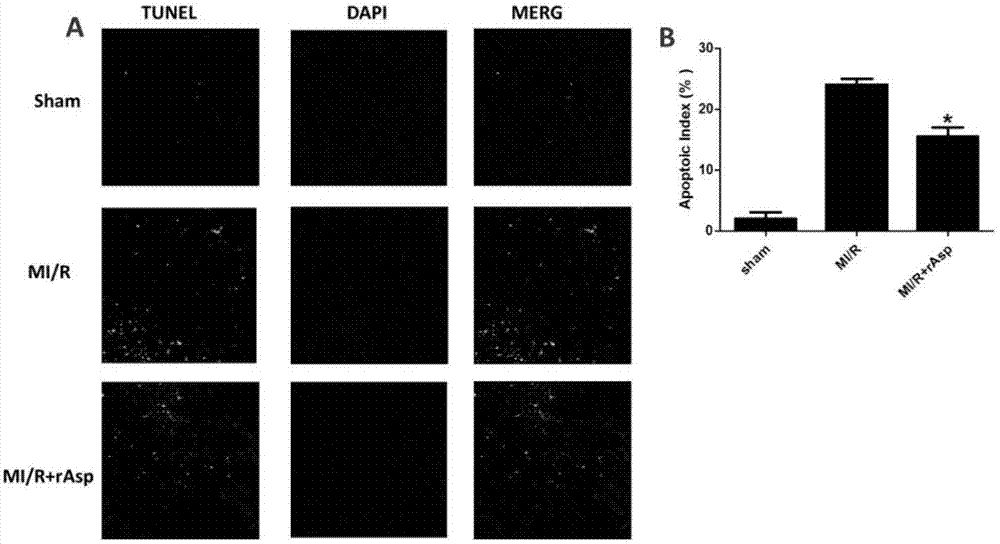 Application of Asprosin for preparing drugs for treating ischemic heart disease