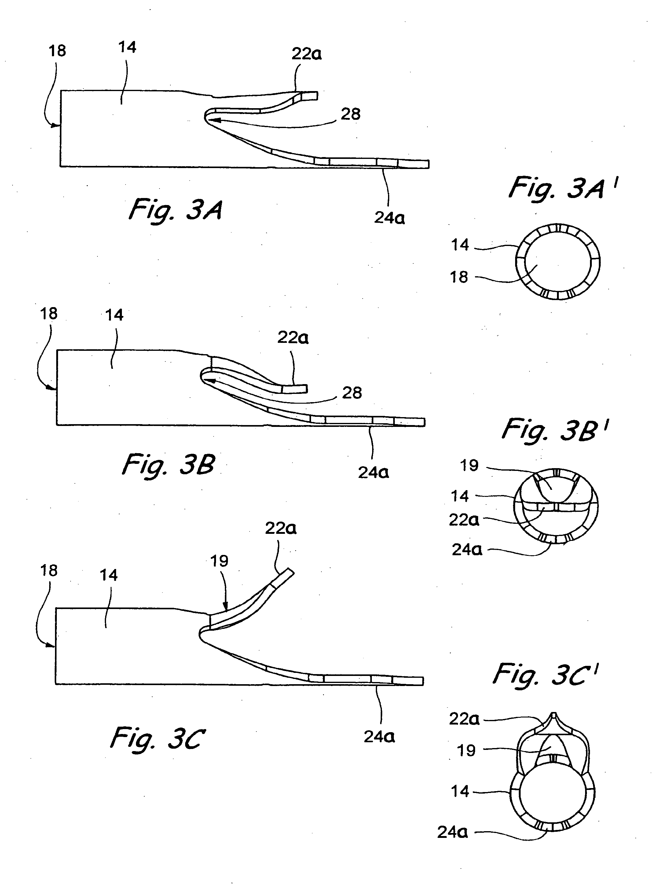 Devices and Methods Useable for Treatment of Glaucoma and Other Surgical Prcedures