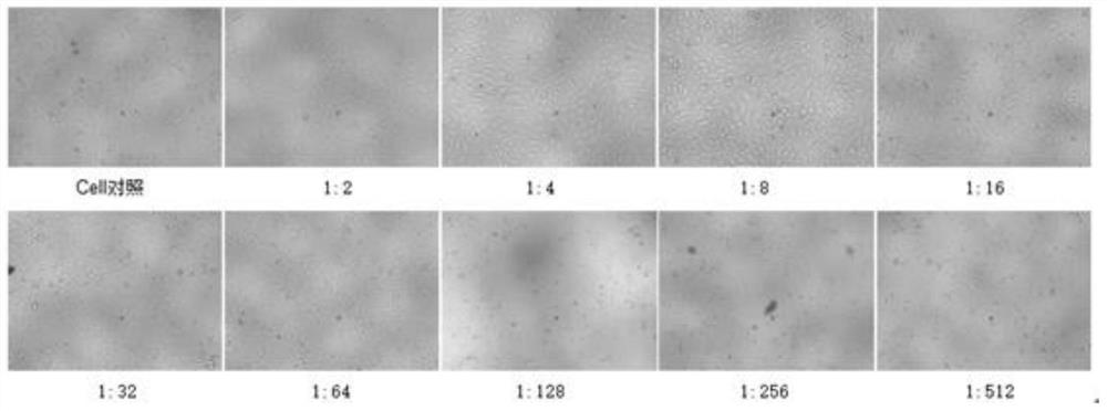 Application of Xiasangju in the preparation of medicines for preventing and treating hand-foot-mouth disease