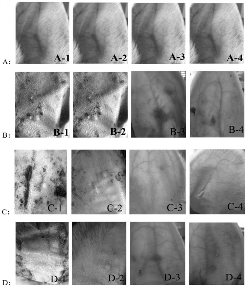 Application of atractylodes in the preparation of inhibitors of Propionibacterium acnes