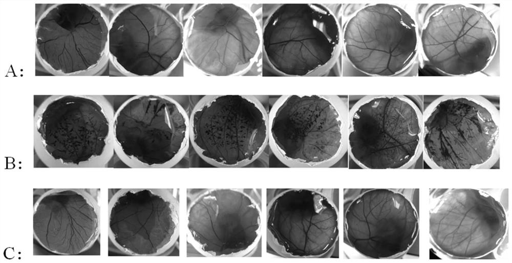 Application of atractylodes in the preparation of inhibitors of Propionibacterium acnes