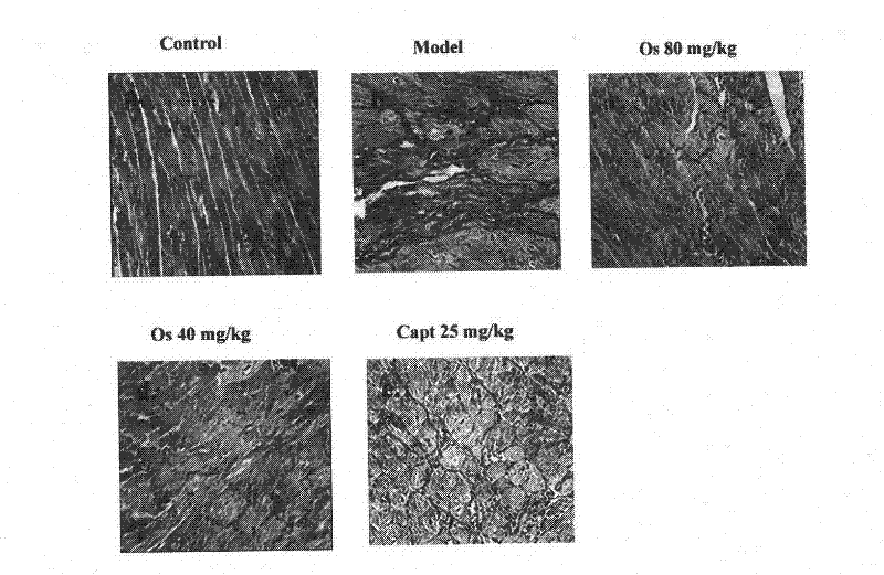 Application of osthole in preparation of medicament for preventing and treating myocardial fibrosis