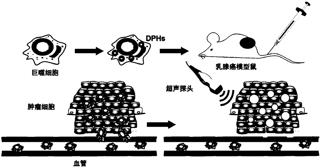 Phase-change mesoporous silicon bionic preparation for targeting controlled release medicine as well as preparation method and application thereof