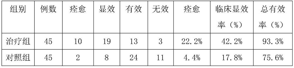 Traditional Chinese medicine composition for treating dizziness and preparation method thereof