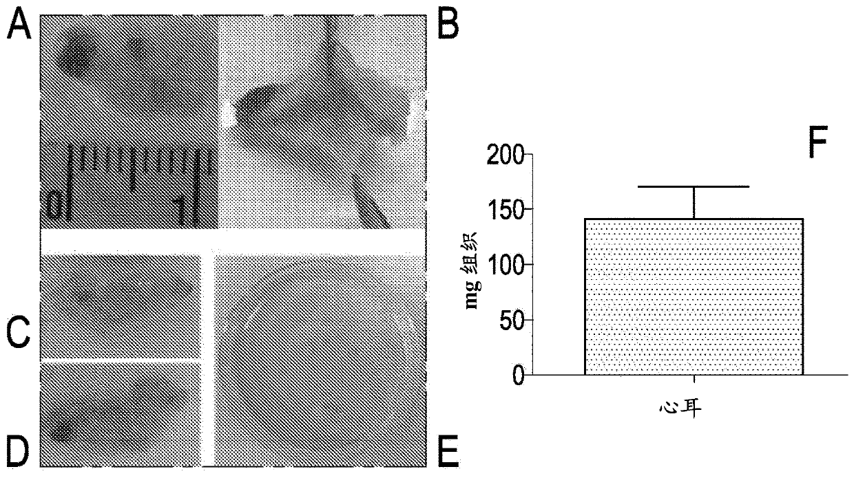 Method for the isolation of subpopulations of cardiac progenitor cells and related uses in the medical field