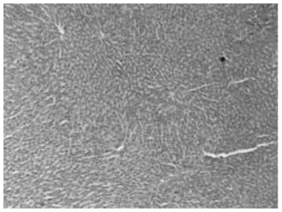 Application of 5-methyltetrahydrofolate and composition containing 5-methyltetrahydrofolate