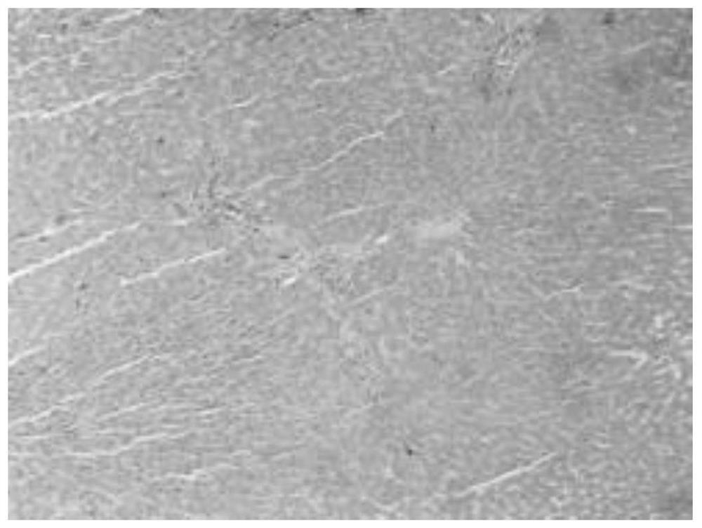 Application of 5-methyltetrahydrofolate and composition containing 5-methyltetrahydrofolate