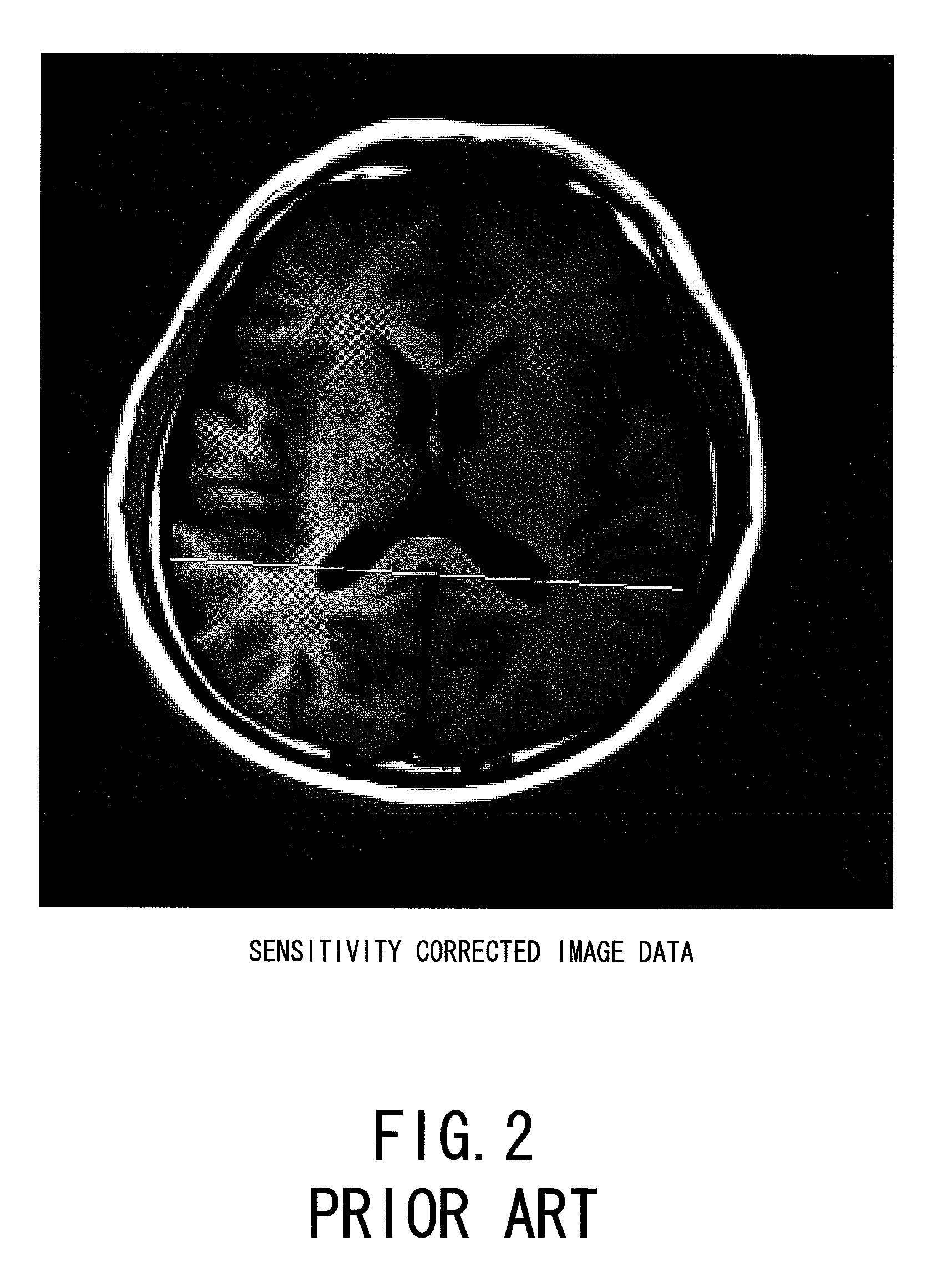 Magnetic resonance imaging apparatus and magnetic resonance imaging method for improving uniformity in sensitivity map