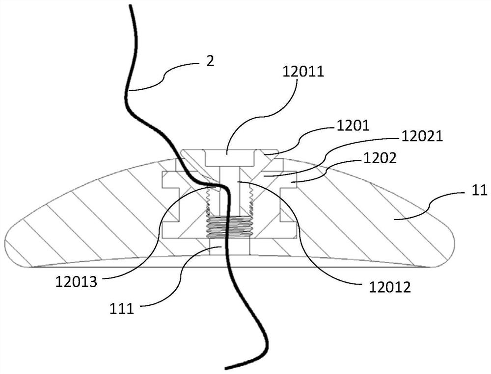 Fixtures for Interventional Medical Devices