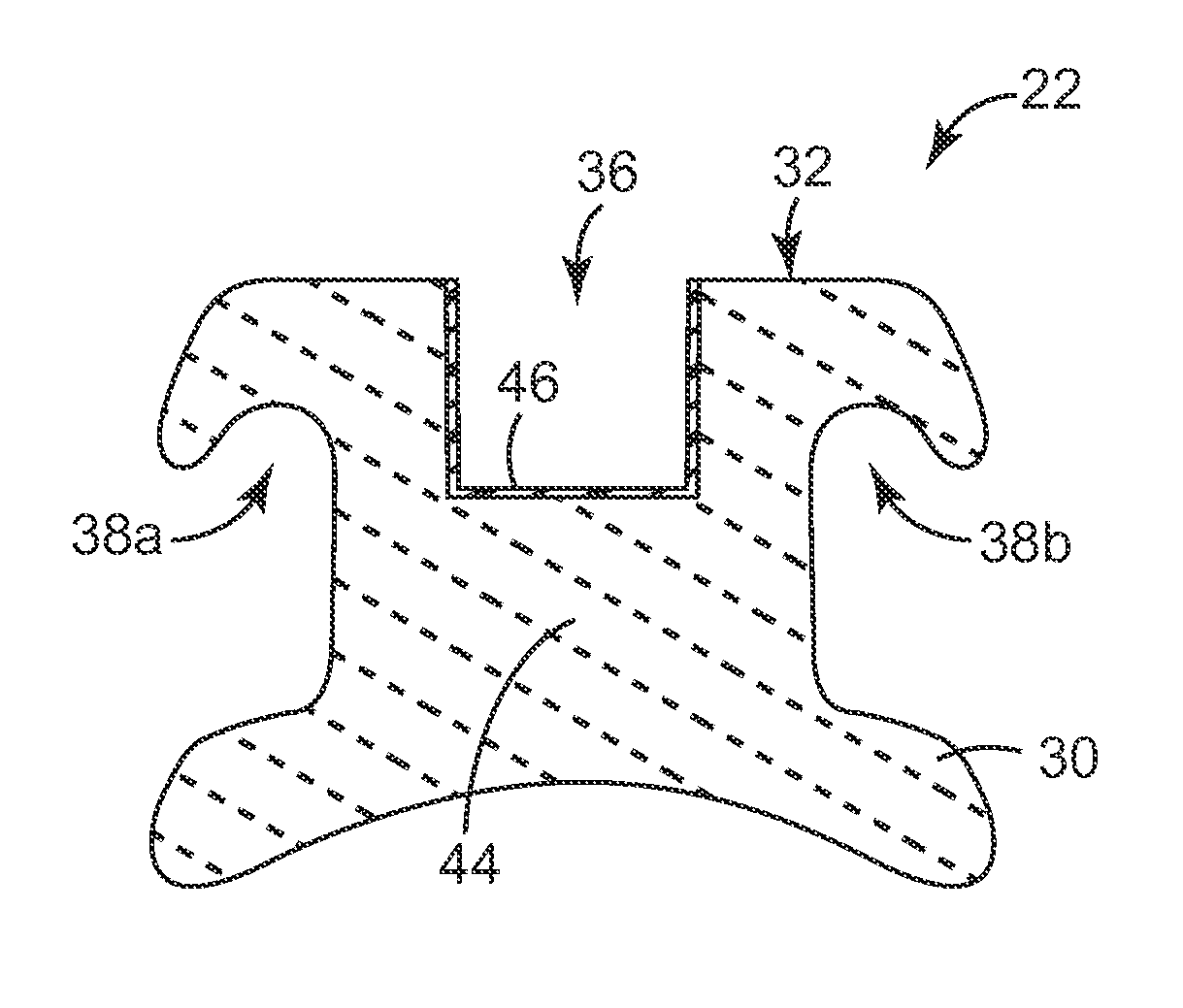 Coated Dental Articles and Related Methods of Manufacture