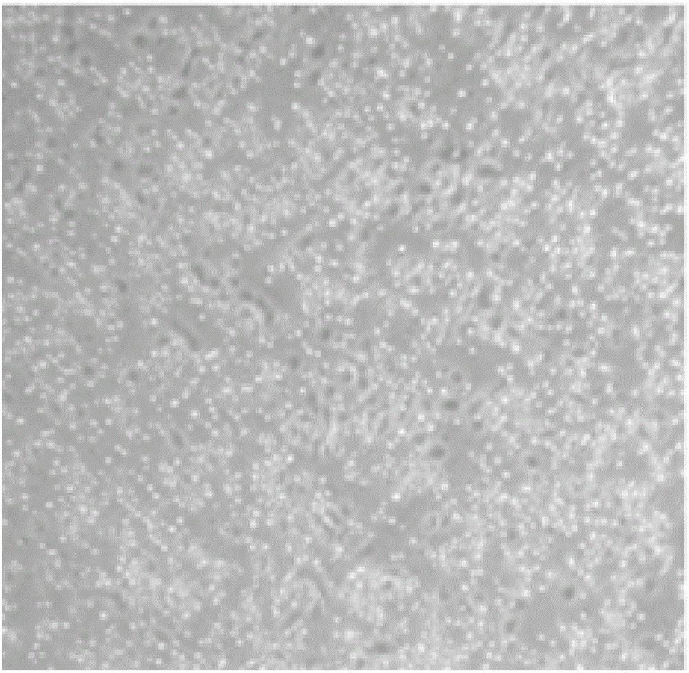 Human amniotic epithelial cell as well as isolated culture method and application thereof