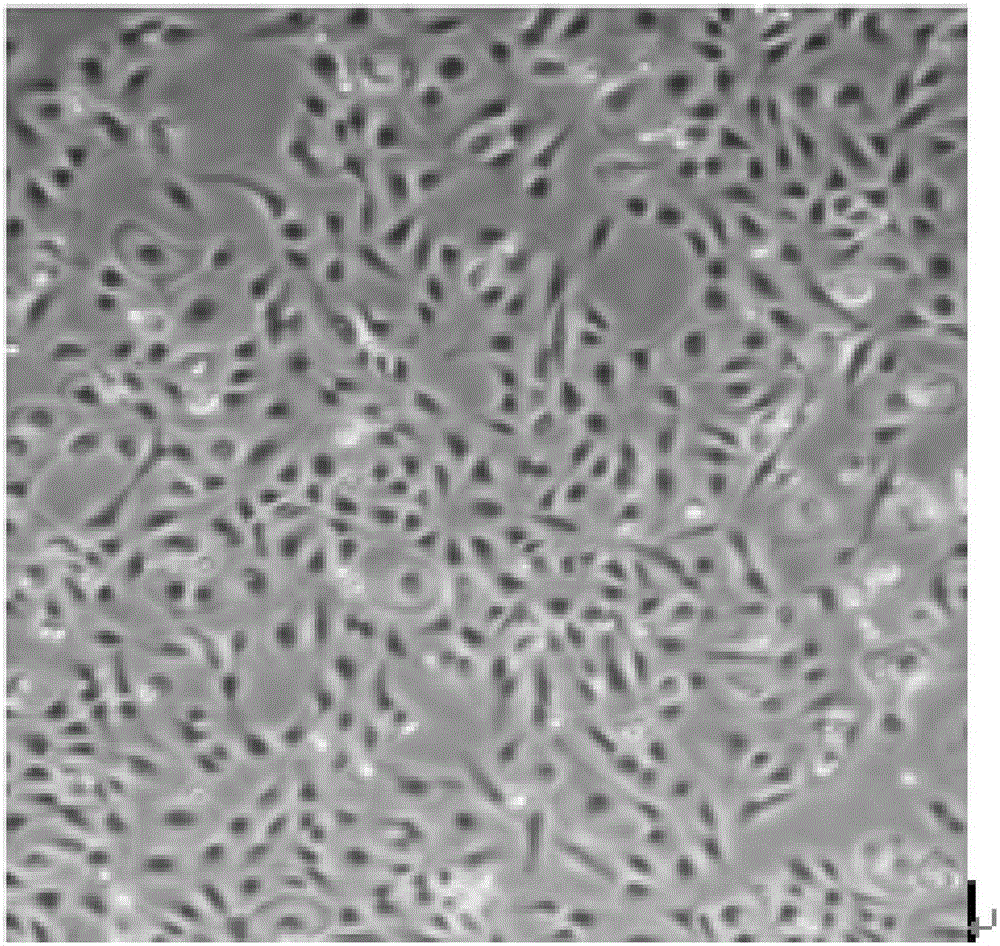 Human amniotic epithelial cell as well as isolated culture method and application thereof