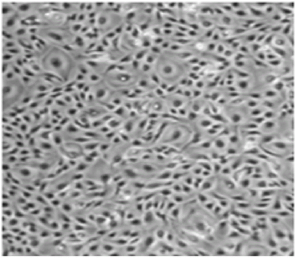 Human amniotic epithelial cell as well as isolated culture method and application thereof