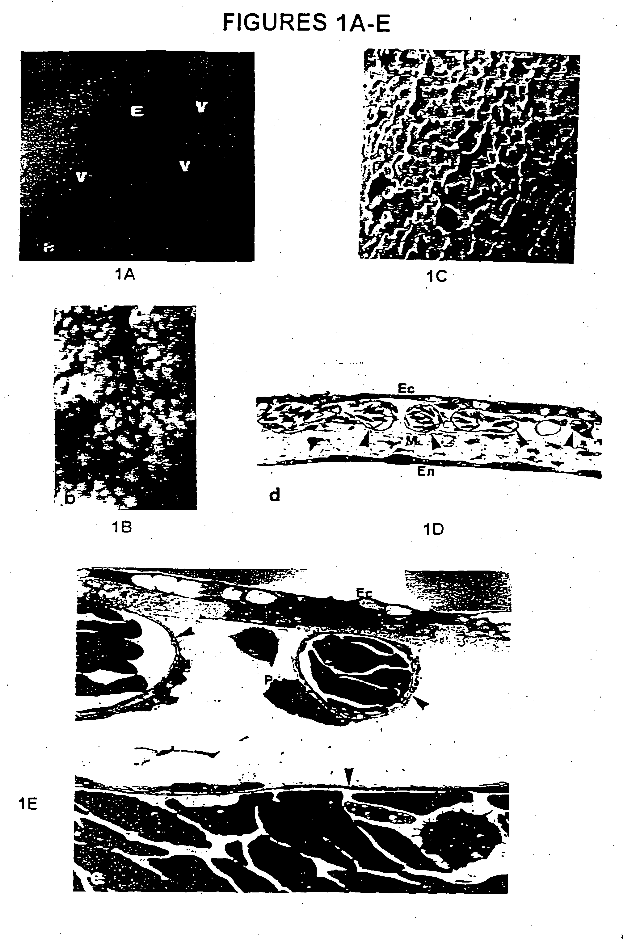 Anti-angiogenic compositions and methods of use